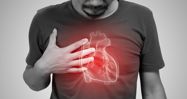 Image overlay of arrhythmia on man's chest