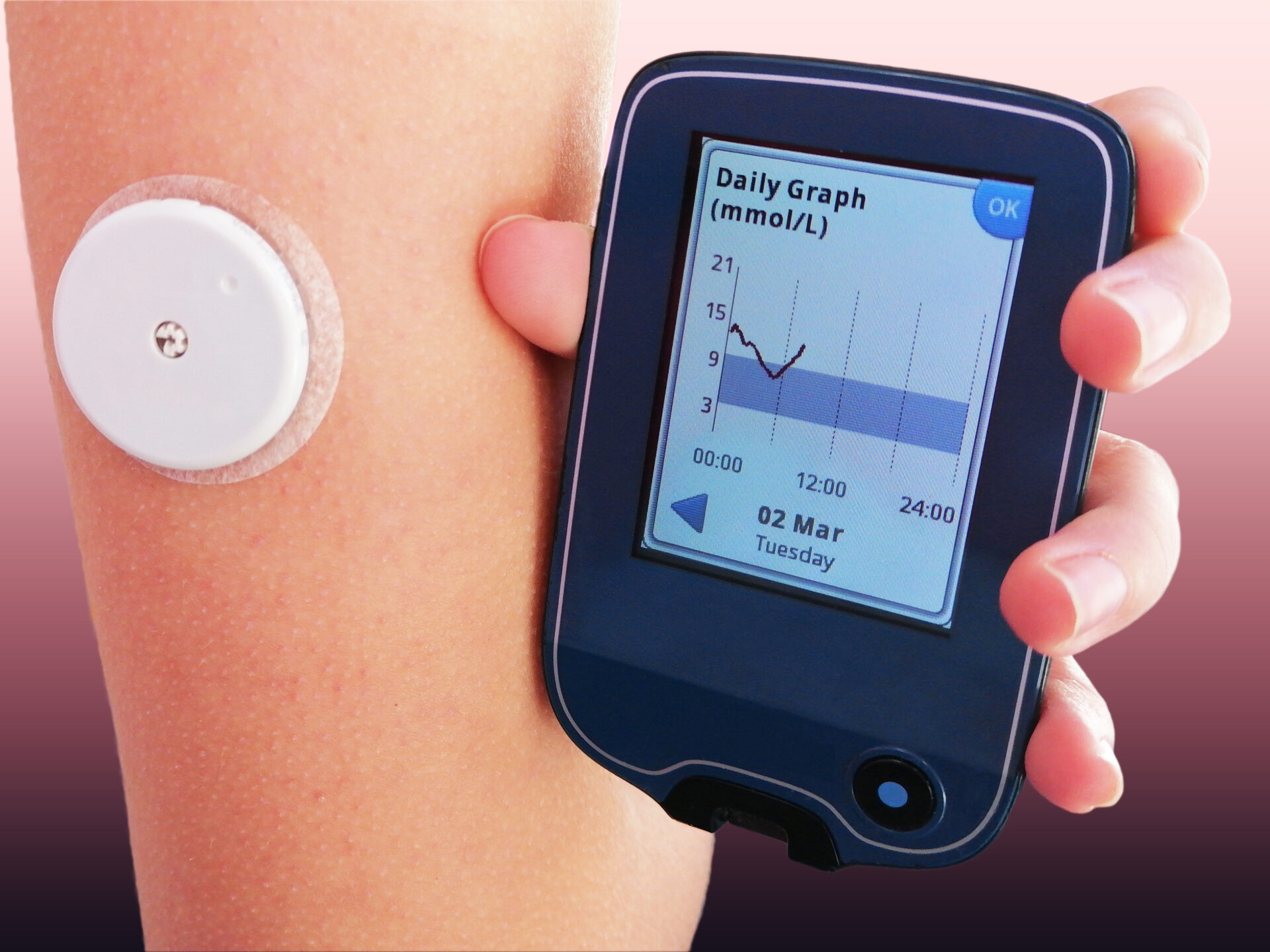 dexcom-inc-kaplan-fox